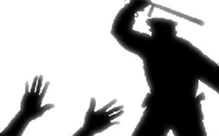 Emniyet Görevlilerinin Keyfi ve Ayrımcı Muamelesi Kabul Edilemez