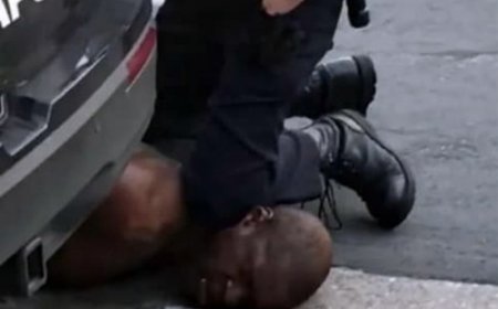 ABD, Polis Şiddetine Son Vermelidir!