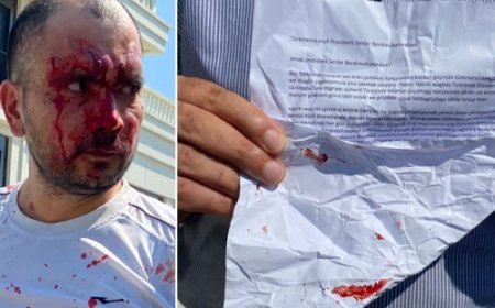 Basın Açıklaması Yapmak İsteyen Türkmenlerin Konsolosluk Çalışanlarınca Darp Edilmesi Kabul Edilemez