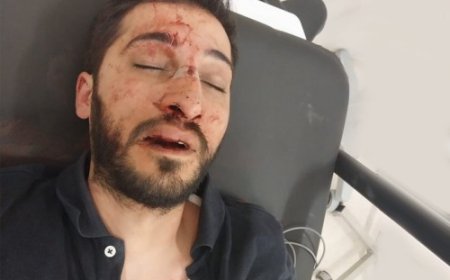 Polis Şiddetine Karşı Etkin Önlemler Alınmalıdır